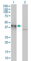 Anti-DCX Mouse Monoclonal Antibody [clone: 1G12]