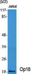 Anti-Stathmin 1 Rabbit Polyclonal Antibody