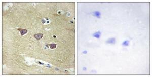 Immunohistochemical analysis of paraffin-embedded human brain tissue using Anti-CAMK5 Antibody. The right hand panel represents a negative control, where the antibody was pre-incubated with the immunising peptide.