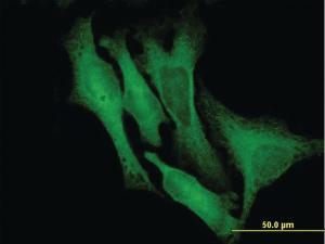 Anti-DCX Mouse Monoclonal Antibody [clone: 1G12]