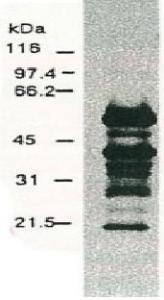 Anti-Hepatitis C Virus NS5a Antibody