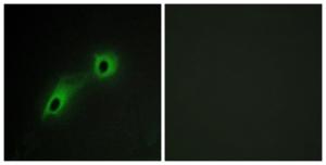 Immunofluorescence analysis of HeLa cells using Anti-CAMK5 Antibody. The right hand panel represents a negative control, where the antibody was pre-incubated with the immunising peptide.