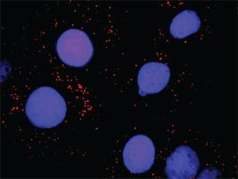 Anti-SMARCB1 + BAZ1B Antibody Pair