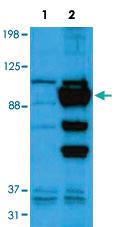 Anti-GPC1 Rabbit Polyclonal Antibody