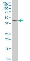 Anti-NR2E1 Mouse Monoclonal Antibody [clone: 4G12]