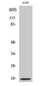 Anti-Stathmin 1 Rabbit Polyclonal Antibody