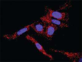 Anti-IKBKB + FOXO3 Antibody Pair