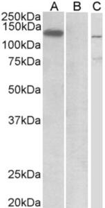 HEK293 lysate (10 µg protein in RIPA buffer) overexpressing Human MIB1 with C-terminal MYC tag probed with EB11532 (1 µg/ml) in Lane A and probed with anti-MYC Tag (1/1000) in lane C. Mock-transfected HEK293 probed with EB11532 (1mg/ml) in Lane B. Primary i