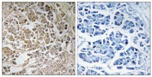 Immunohistochemical analysis of paraffin-embedded human pancreas using Anti-PEX11C Antibody The right hand panel represents a negative control, where the antibody was pre-incubated with the immunising peptide