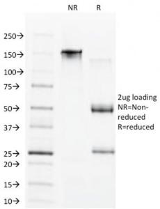 SDS-PAGE analysis of Anti-CDX1 Antibody [CDX1/1650] under non-reduced and reduced conditions; showing intact IgG and intact heavy and light chains, respectively SDS-PAGE analysis confirms the integrity and purity of the antibody