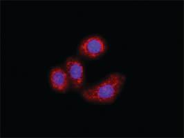 Anti-IKBKB + FOXO3 Antibody Pair