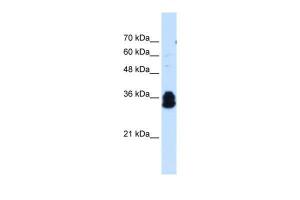 Anti-FAM134B Rabbit Polyclonal Antibody