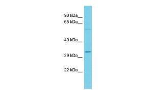 Anti-OR7A5 Rabbit Polyclonal Antibody