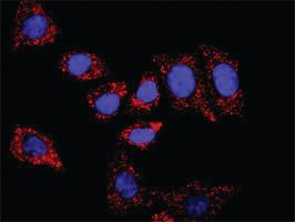 Anti-IKBKB + FOXO3 Antibody Pair