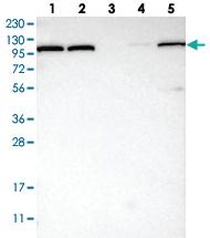 Anti-OGDH Rabbit Polyclonal Antibody