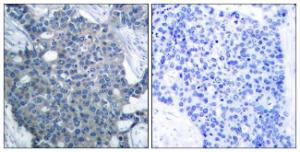 Anti-Stathmin 1 antibody