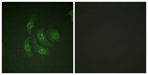 Immunofluorescence analysis of HepG2 cells using Anti-CaMK4 Antibody. The right hand panel represents a negative control, where the antibody was pre-incubated with the immunising peptide.