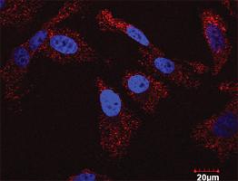 Anti-IKBKB + FOXO3 Antibody Pair