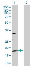 Anti-TSC22D1 Rabbit Polyclonal Antibody