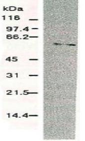 Anti-Hepatitis C Virus NS5b Antibody