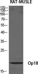 Anti-Stathmin 1 antibody