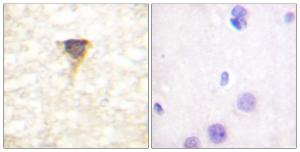 Immunohistochemical analysis of paraffin-embedded human brain tissue using Anti-CaMK4 Antibody. The right hand panel represents a negative control, where the antibody was pre-incubated with the immunising peptide.