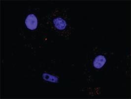 Anti-AKT1 + BAD Antibody Pair