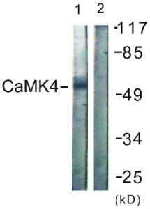 Western blot analysis of lysates from K562 cells, treated with H2O2 100uM 30' using Anti-CaMK4 Antibody. The right hand lane represents a negative control, where the antibody is blocked by the immunising peptide.