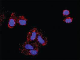 Anti-AKT1 + BAD Antibody Pair