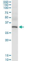 Anti-CBR1 Polyclonal Antibody Pair