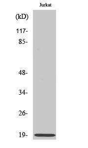 Anti-Stathmin 1 antibody