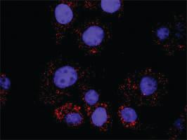 Anti-AKT1 + BAD Antibody Pair