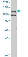 Anti-EHMT1 Mouse Monoclonal Antibody [clone: 3G1]