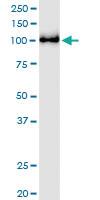 Anti-KDM1A Polyclonal Antibody Pair