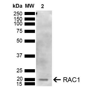 Western blot analysis of human Embryonic kidney epithelial cell line (HEK293T) lysate showing detection of ~21 kDa RAC1 protein using Anti-Rac1 Antibody (A304869) at 1:1,000 for 2 hours at room temperature