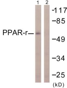 Anti-PPAR gamma 1+2 Rabbit Polyclonal Antibody