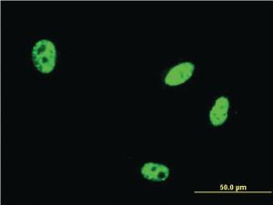 Anti-EHMT1 Mouse Monoclonal Antibody [clone: 3G1]