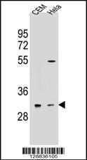 Anti-OR5L2 Rabbit Polyclonal Antibody (PE (Phycoerythrin))