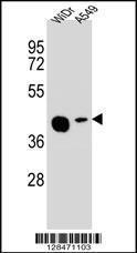 Anti-SLC35G5 Rabbit Polyclonal Antibody (HRP (Horseradish Peroxidase))