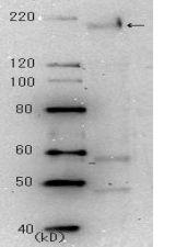 Anti-SARS Spike Glycoprotein Antibod