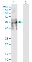 Anti-DDC Mouse Monoclonal Antibody [clone: 8E8]