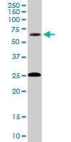 Anti-GAD2 Goat Polyclonal Antibody