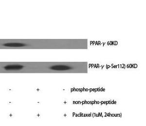 Anti-PPAR gamma 1+2 Rabbit Polyclonal Antibody