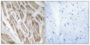 Immunohistochemical analysis of paraffin-embedded human heart using Anti-NDUFS5 Antibody. The right hand panel represents a negative control, where the antibody was pre-incubated with the immunising peptide.