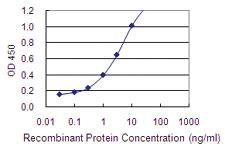 Anti-DDC Mouse Monoclonal Antibody [clone: 8E8]