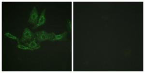 Immunofluorescence analysis of HepG2 cells using Anti-BCL-2 Antibody The right hand panel represents a negative control, where the antibody was pre-incubated with the immunising peptide