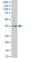 Anti-AKR1C1 Mouse Polyclonal Antibody