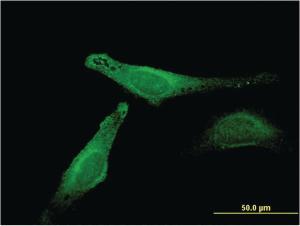 Anti-MB Mouse Monoclonal Antibody [clone: 4F8]