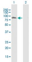 Anti-LRSAM1 Rabbit Polyclonal Antibody