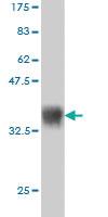 Anti-ULK2 Mouse Monoclonal Antibody [clone: 2A12]